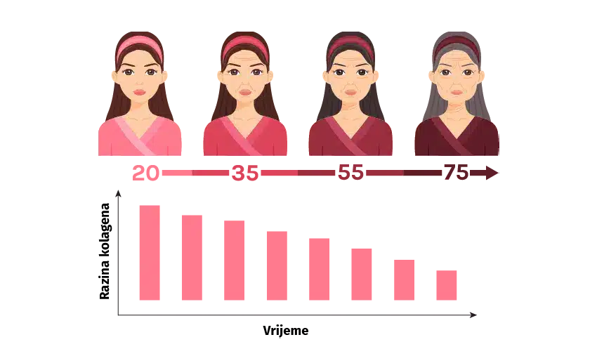 Slika opcije proizvoda