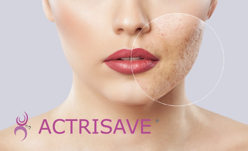 Slika opcije proizvoda