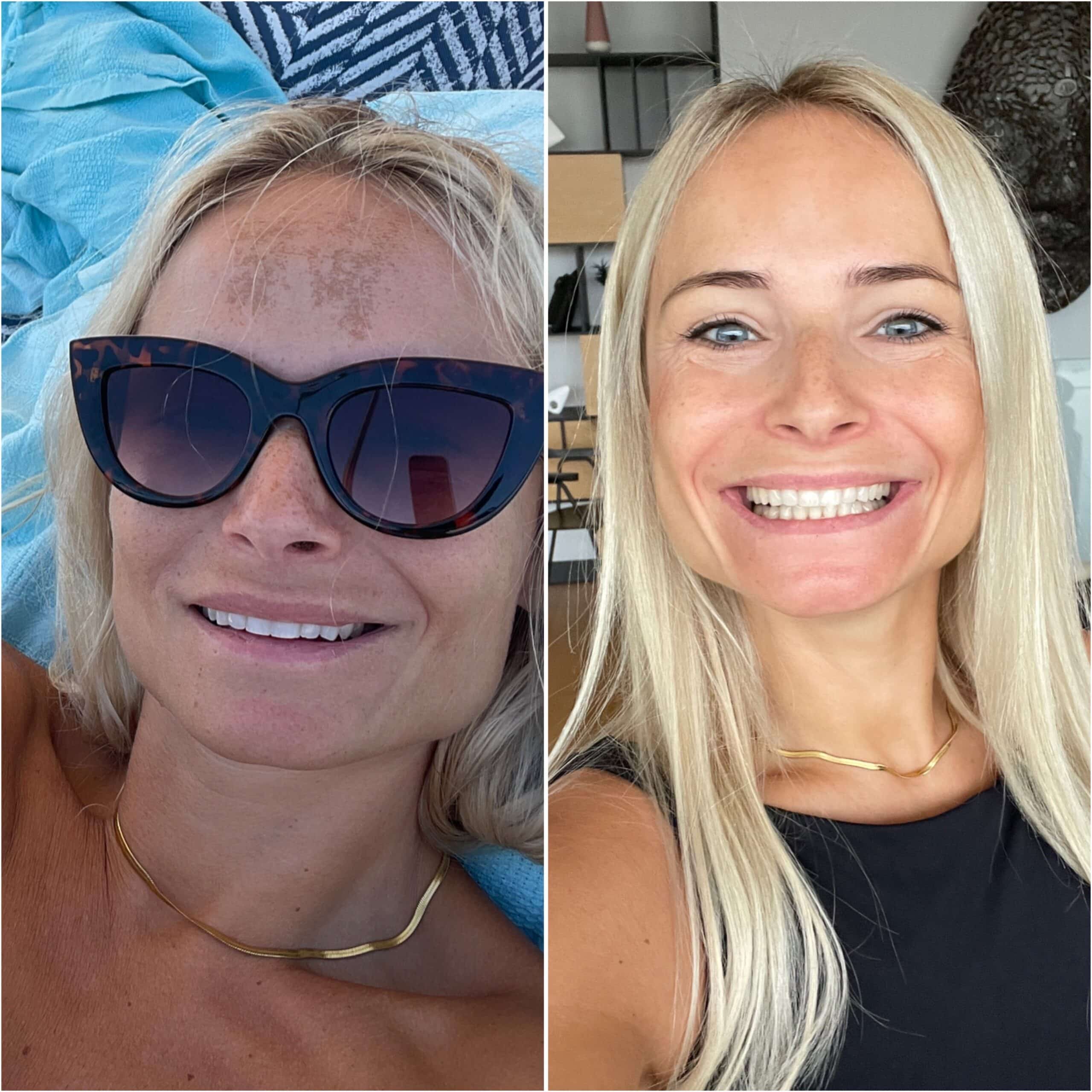 Slika opcije proizvoda